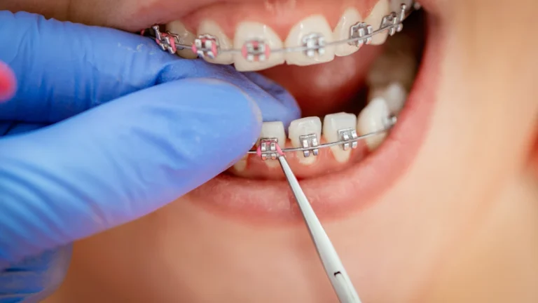 How Board-Certified Orthodontists Address Aesthetic and Functional Needs?